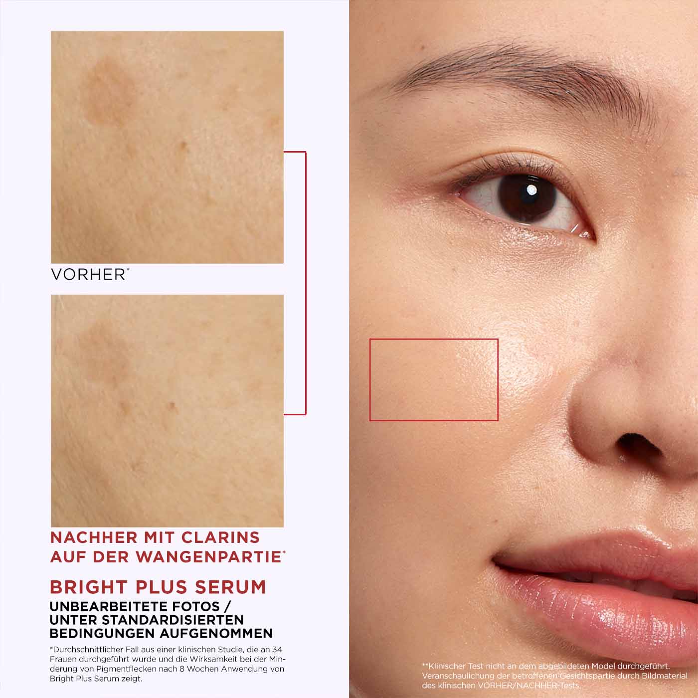 Vorher-Nachher-Bilder, die die Veränderung der Haut zeigen und die Wirksamkeit des Produkts bei Pigmentflecken verdeutlichen.