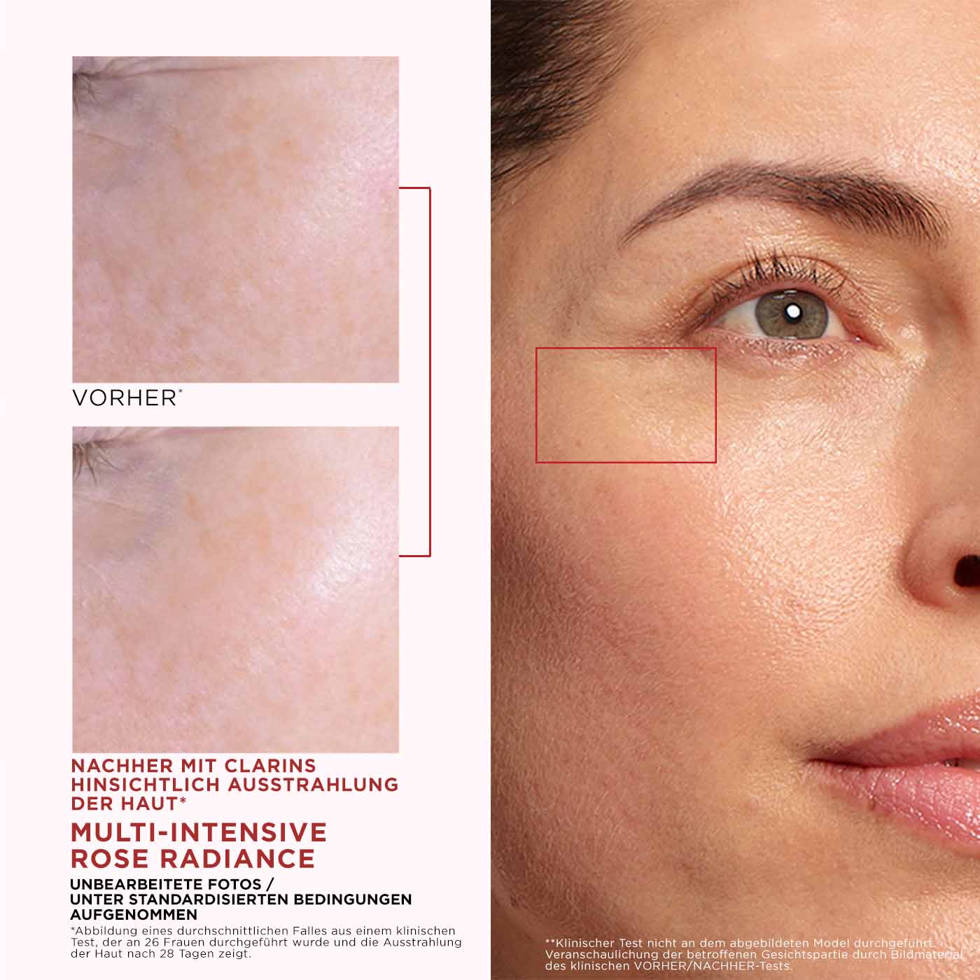 Vorher-Nachher-Bilder, zeigen die Hautveränderung und die Fähigkeit der regenerierenden Creme, sie  zum Strahlen zu bringen