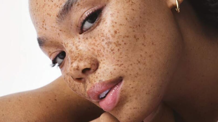 Nahaufnahme des Gesichts einer Frau mit nat&uuml;rlichem Glow, wobei der Glow-Effekt als einer der wichtigsten Vorteile von Vitamin C f&uuml;r die Haut hervorgehoben wird.